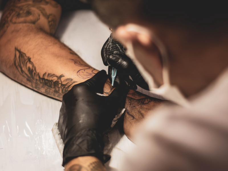 Quanto costa rimuovere un tatuaggio