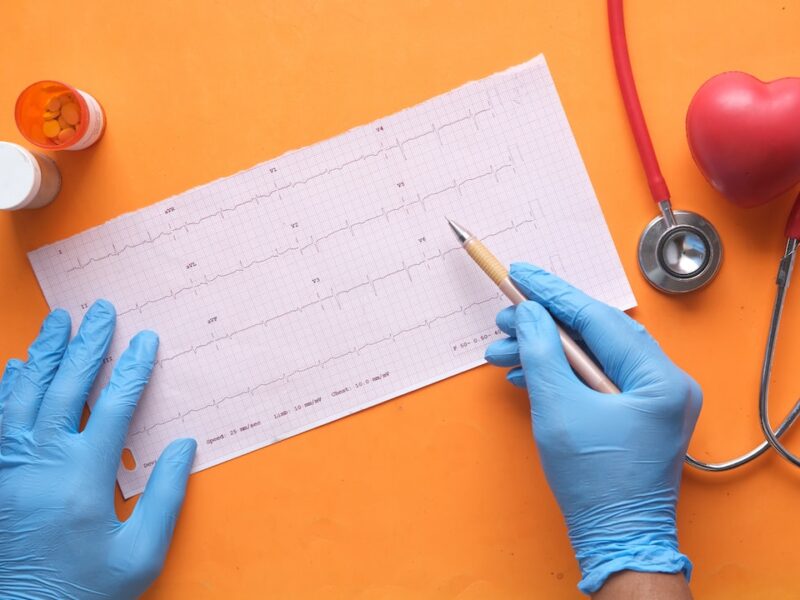 Quanto costa un elettrocardiogramma