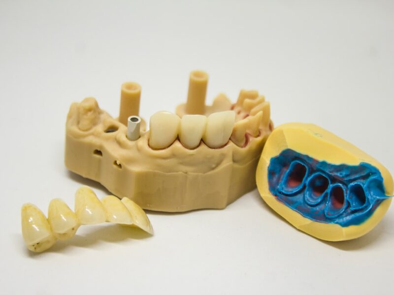 Quanto costa una capsula dentale