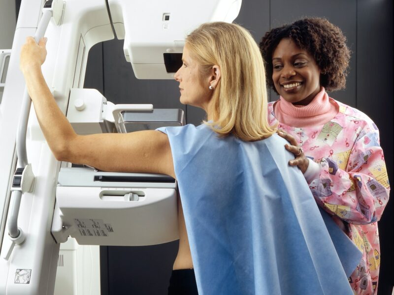 Quanto costa una mammografia