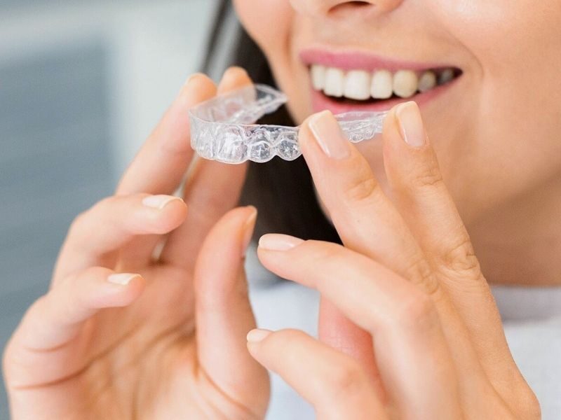 Quanto costa invisalign